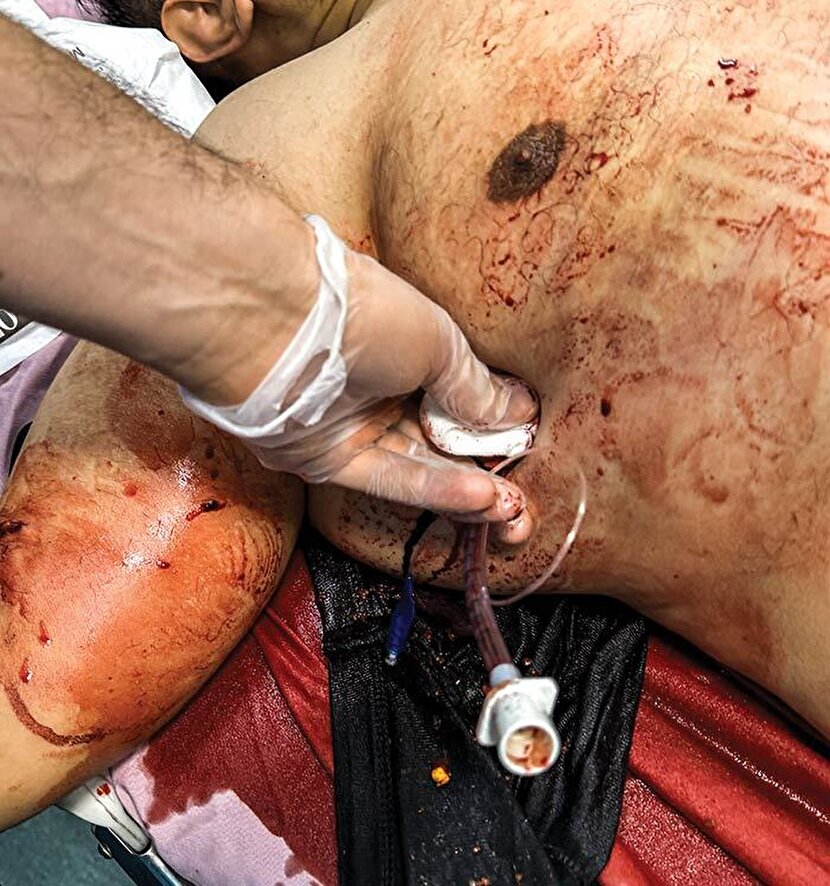 عملیات کشته‌سازی