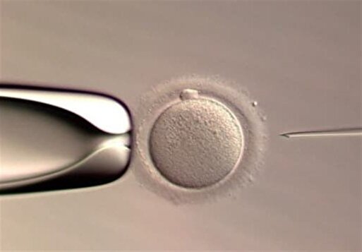 نخستین نوزاد متولد شده با سیستم هوش مصنوعی در IVF دنیا آمد
